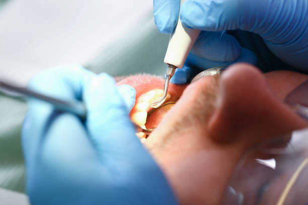 Best Emergency Dental Extractions in Vilonia, AR