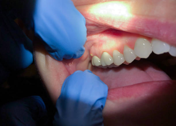 Best Urgent Dental Care for Toothache in Vilonia, AR